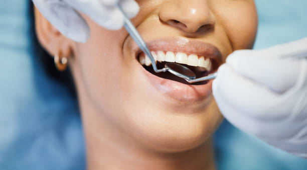 Best Broken or Chipped Tooth Repair in Sulligent, AL